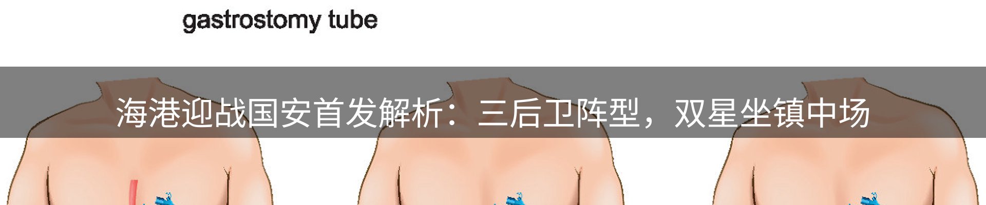 资讯解读